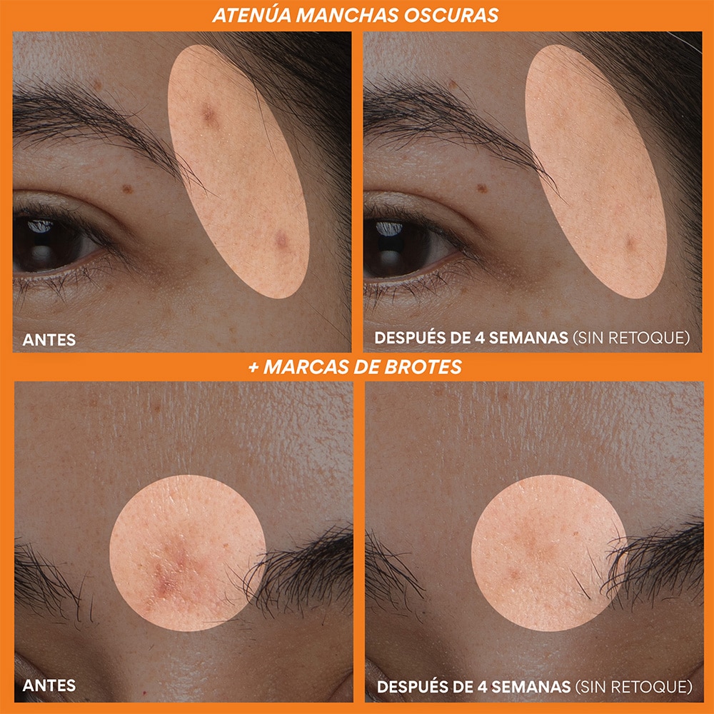 RAPID VITAMIN C BRIGHTENING SERUM FOR DARK SPOTS + POST-BREAKOUT MARKS (S&Eacute;RUM DE VITAMINA C)